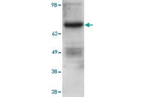 Western blot using PRKCB polyclonal antibody  shows detection of PRKCB in ~25 ug of U251 whole cell lysate (glioma derived). (PKC beta antibody  (Internal Region))