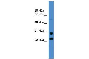 WB Suggested Anti-KIAA0152  Antibody Titration: 0. (Malectin antibody  (C-Term))