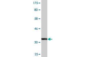 Western Blot detection against Immunogen (32. (ZFAND3 antibody  (AA 2-60))