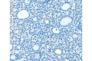 Immunohistochemistry (IHC) image for anti-Neurogenin 3 (NEUROG3) antibody (ABIN1873885) (Neurogenin 3 antibody)