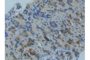 IHC-P analysis of Mouse Stomach Tissue, with DAB staining. (MMP14 antibody  (AA 121-487))