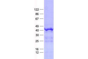 Proline Rich 11 (PRR11) protein (His tag)