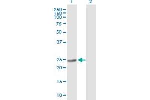 Western Blot analysis of BDH2 expression in transfected 293T cell line by BDH2 MaxPab polyclonal antibody.