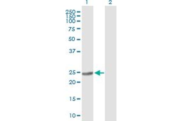 BDH2 antibody  (AA 1-245)