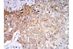 Immunohistochemistry (IHC) image for anti-Phospholipase D2 (PLD2) (AA 834-933) antibody (ABIN5881791) (Phospholipase D2 antibody  (AA 834-933))