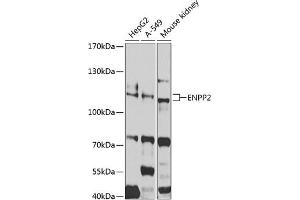 Western blot analysis of extracts of various cell lines, using ENPP2 antibody (ABIN3023333, ABIN3023334, ABIN3023335 and ABIN6219607) at 1:1000 dilution. (ENPP2 antibody  (AA 564-863))