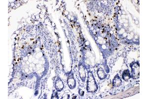 Immunohistochemistry (IHC) image for anti-Aldo-Keto Reductase Family 1, Member B1 (Aldose Reductase) (AKR1B1) (AA 228-316) antibody (ABIN4886447)