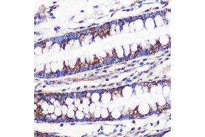 Immunohistochemistry of paraffin-embedded Human colon using MRPL54 Rabbit pAb (ABIN7268578) at dilution of 1:100 (40x lens). (MRPL54 antibody  (AA 1-138))