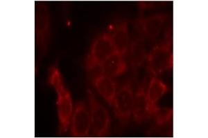 Image no. 3 for anti-Protein-tyrosine Phosphatase 1C (PTPN6) (Tyr536) antibody (ABIN197592) (SHP1 antibody  (Tyr536))