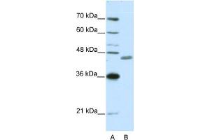 WB Suggested Anti-ZNF396 Antibody Titration:  0.