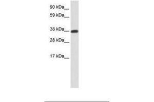 Image no. 1 for anti-DMRT-Like Family C2 (DMRTC2) (N-Term) antibody (ABIN6736076)
