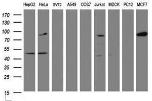Image no. 2 for anti-ATR Interacting Protein (ATRIP) (AA 42-309) antibody (ABIN1491509) (ATRIP antibody  (AA 42-309))