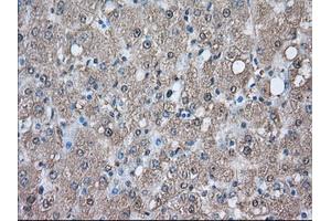 Immunohistochemical staining of paraffin-embedded Human prostate tissue using anti-PIM2 mouse monoclonal antibody.