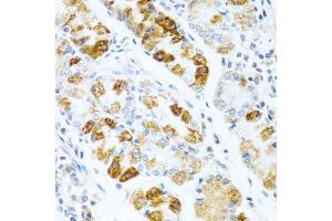 Immunohistochemistry of paraffin-embedded human stomach using BMP3 antibody. (BMP3 antibody  (AA 243-472))