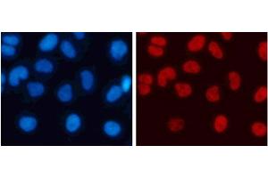 Immunofluorescence analysis of 293T cells using DiMethyl-Histone H3-K4 Polyclonal Antibody (Histone 3 antibody  (2meLys4))