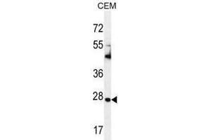 TIMP1 Antibody (C-term) western blot analysis in CEM cell line lysates (35 µg/lane).