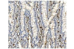 IHC analysis of BubR1/BUB1B using anti-BubR1/BUB1B antibody (ABIN7600961). (BUB1B antibody  (AA 26-448))