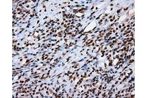 Immunohistochemical staining of paraffin-embedded Kidney tissue using anti-KIAA1609 mouse monoclonal antibody. (KIAA1609 antibody)