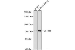 Western blot analysis of extracts of various cell lines using ZBTB33 Polyclonal Antibody at dilution of 1:3000. (ZBTB33 antibody)