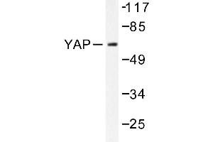 Image no. 1 for anti-Yes-Associated Protein 1 (YAP1) antibody (ABIN272105) (YAP1 antibody)