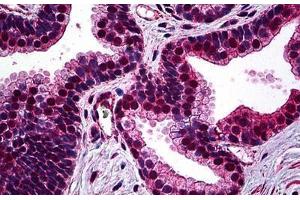 Human Prostate: Formalin-Fixed, Paraffin-Embedded (FFPE) (SMC1A antibody  (AA 366-466))