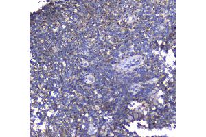 IHC analysis of Synaptotagmin 1 using anti-Synaptotagmin 1 antibody . (SYT1 antibody)