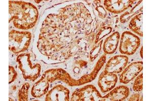 IHC image of ABIN7144087 diluted at 1:121 and staining in paraffin-embedded human kidney tissue performed on a Leica BondTM system. (Angiomotin antibody  (AA 1-300))