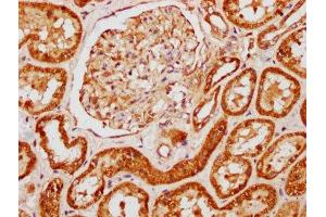 IHC image of ABIN7144087 diluted at 1:121 and staining in paraffin-embedded human kidney tissue performed on a Leica BondTM system.