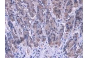 #VALUE! (MRPL1 antibody  (AA 141-323))