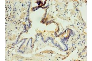 Immunohistochemistry of paraffin-embedded human lung tissue using ABIN7163325 at dilution of 1:100