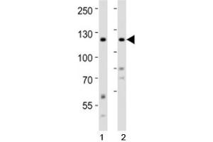 Western blot analysis of lysate from 1) HeLa and 2) SH-SY5Y cell line using Ror2 antibody at 1:1000. (ROR2 antibody  (AA 750-800))