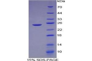 SDS-PAGE of Protein Standard from the Kit (Highly purified E.