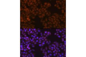 Immunofluorescence analysis of HeLa cells using FSP1/S100 Rabbit mAb (ABIN7270125) at dilution of 1:100 (40x lens).