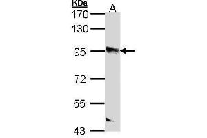 WB Image Sample (30 ug of whole cell lysate) A: A431 , 7. (PPFIBP2 antibody  (Center))