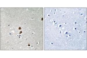 Immunohistochemistry analysis of paraffin-embedded human brain, using CtBP1 (Phospho-Ser422) Antibody. (CTBP1 antibody  (pSer422))