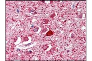 Image no. 1 for anti-Parvalbumin (PVALB) (C-Term) antibody (ABIN374572) (PVALB antibody  (C-Term))