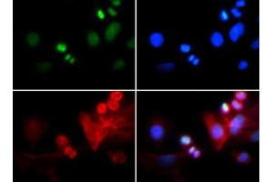 Immunofluorescence of Rabbit Anti-Histone H3 [Trimethyl Lys4, p Thr6] Antibody. (Histone 3 antibody  (H3K4me3, pThr6))