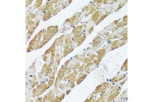 Immunohistochemistry of paraffin-embedded mouse heart using C antibody (ABIN7266047) at dilution of 1:100 (40x lens). (CASQ2 antibody  (AA 20-399))