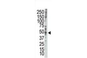 Western Blotting (WB) image for anti-RAD9 Homolog A (S. Pombe) (RAD9A) (BH3 Domain) antibody (ABIN2997201) (RAD9A antibody  (BH3 Domain))