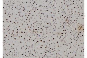 ABIN6277504 at 1/100 staining Mouse liver tissue by IHC-P.