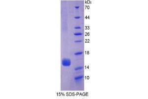 SDS-PAGE of Protein Standard from the Kit (Highly purified E.