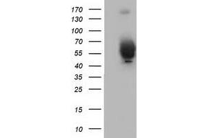 Western Blotting (WB) image for anti-Bestrophin 3 (BEST3) antibody (ABIN1501729)