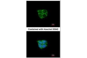 ICC/IF Image Immunofluorescence analysis of paraformaldehyde-fixed A431, using Adenosine kinase, antibody at 1:200 dilution. (ADK antibody)