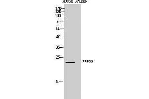 Western Blotting (WB) image for anti-RAS-Like, Family 10, Member A (RASL10A) (Internal Region) antibody (ABIN3186841) (RASL10A antibody  (Internal Region))