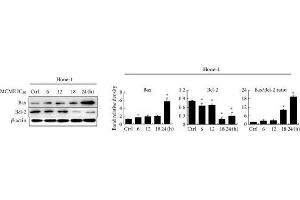 Expression of Bcl-2 family proteins in MCME-treated cancer cells. (Bcl-2 antibody  (N-Term))