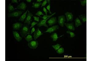 Immunofluorescence of monoclonal antibody to RUNX1 on HeLa cell.