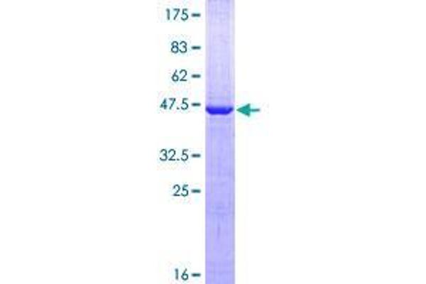 VSTM2L Protein (AA 25-204) (GST tag)