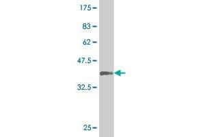 Western Blot detection against Immunogen (37. (SGK2 antibody  (AA 244-344))