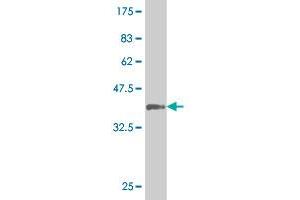 Western Blot detection against Immunogen (37.