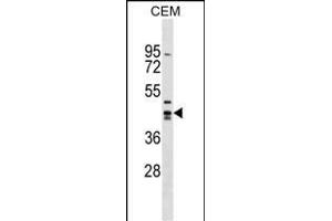ZN Antibody (Center) (ABIN1538101 and ABIN2849088) western blot analysis in CEM cell line lysates (35 μg/lane). (Zinc Finger and SCAN Domain Containing 9 (ZSCAN9) (AA 217-243) antibody)